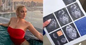 Ιωάννα Τούνη: Έδειξε τον υπέρηχο – Το κόλπο που έκανε για να μην μένει έγκυος touni