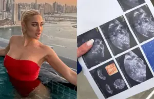 Ιωάννα Τούνη: Έδειξε τον υπέρηχο – Το κόλπο που έκανε για να μην μένει έγκυος touni