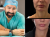 V-LIFT του Dr. Ανδρεανίδη: Μια σύγχρονη προσέγγιση στην ανανέωση του προσώπου Photo Collage Maker_2026_09_08_07_05_07